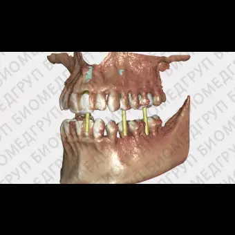 Exocad DICOM viewer средство просмотра DICOM файлов
