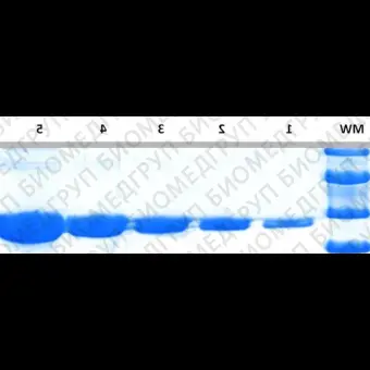 Краситель для белкового фореза InstantBlue Coomassie Protein Stain, Abcam, ab119211, 1 л