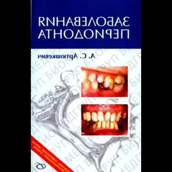 Заболевания периодонта. / Артюшкевич А.С.