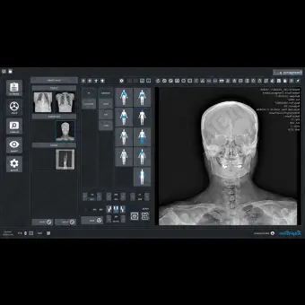 Медицинский модуль программного обеспечения RayinView