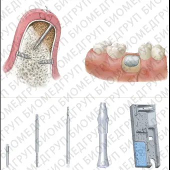 Комплект инструментов для стоматологической хирургии SM01