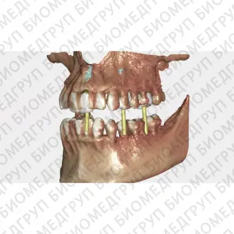 Exocad DICOM viewer средство просмотра DICOM файлов