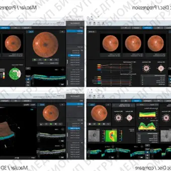 Huvitz HOCT1/1F Оптический когерентный томограф