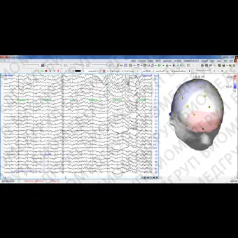 Программное обеспечение для ЭКГ asa