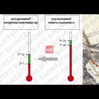 Аппарат локальной криотерапии Cryoflow 1000 IR