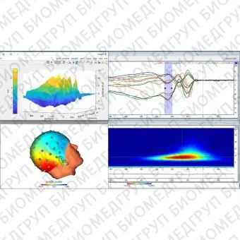 Программное обеспечение для ЭКГ Analyzer 2