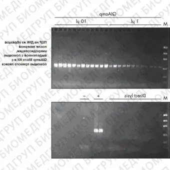 Набор для выделения ДНК из биологических образцов малого объёма QIAamp DNA Miсro Kit, Qiagen, 56304, 50 выделений