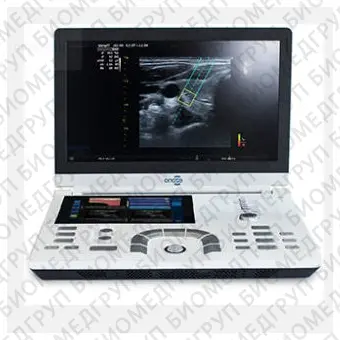 Переносной ультразвуковой сканер eZono5000