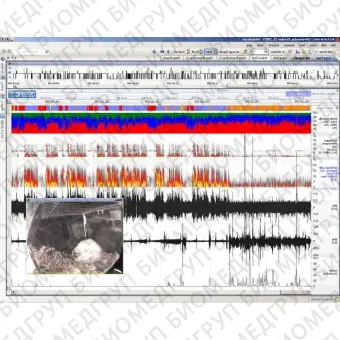 Программное обеспечение для нейрофизиологического стимулирования NeuroScore