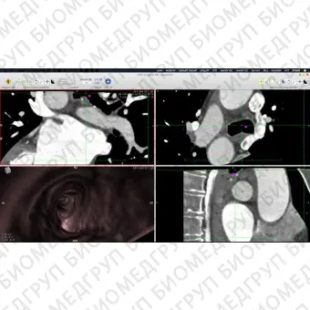 Программное обеспечение SPECT