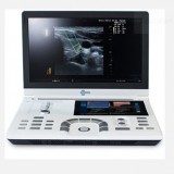 Переносной ультразвуковой сканер eZono®5000