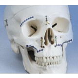 Компрессионная костная пластина для челюстно-лицевого восстановления Optimus Faical System