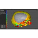 Программное обеспечение для челюстно-лицевой хирургии ADEPT CMF